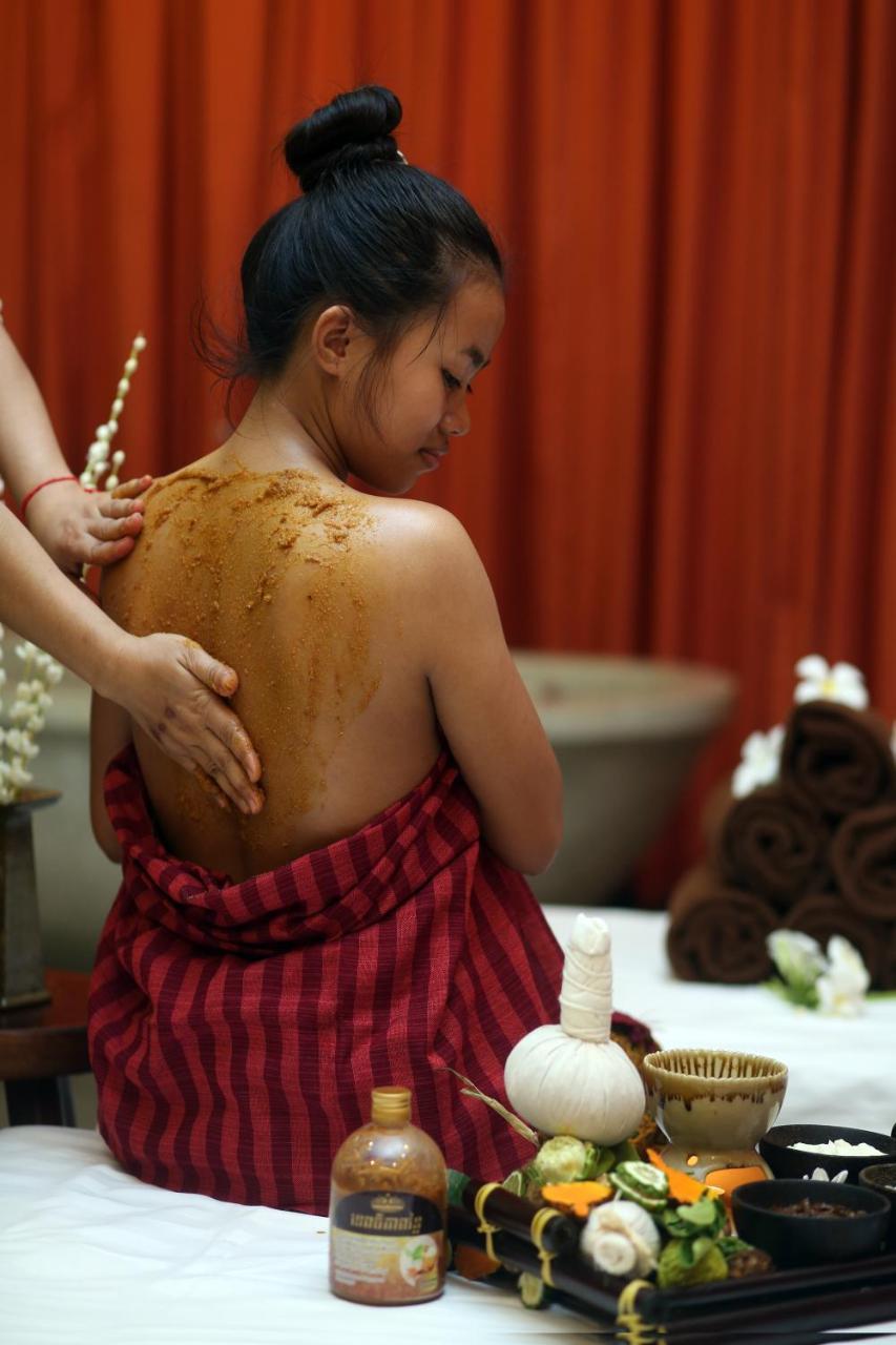 เซ็นทรัล คอร์เนอร์ ดังกอร์ Hotel เสียมราฐ ภายนอก รูปภาพ